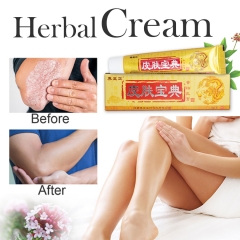 Yongzhi Zheng Herbal Antimicrobial Cream 15g - Soothing Relief for Psoriasis & Itchy Skin. Natural formula combats bacteria, gently treats skin